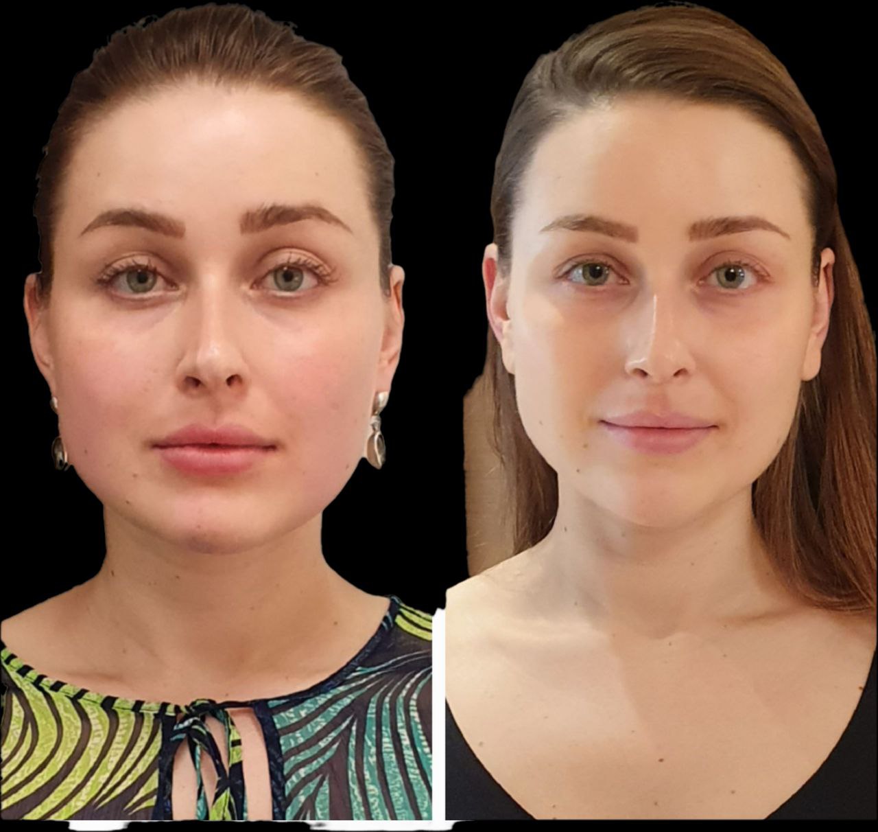 Student transformation before and after 7