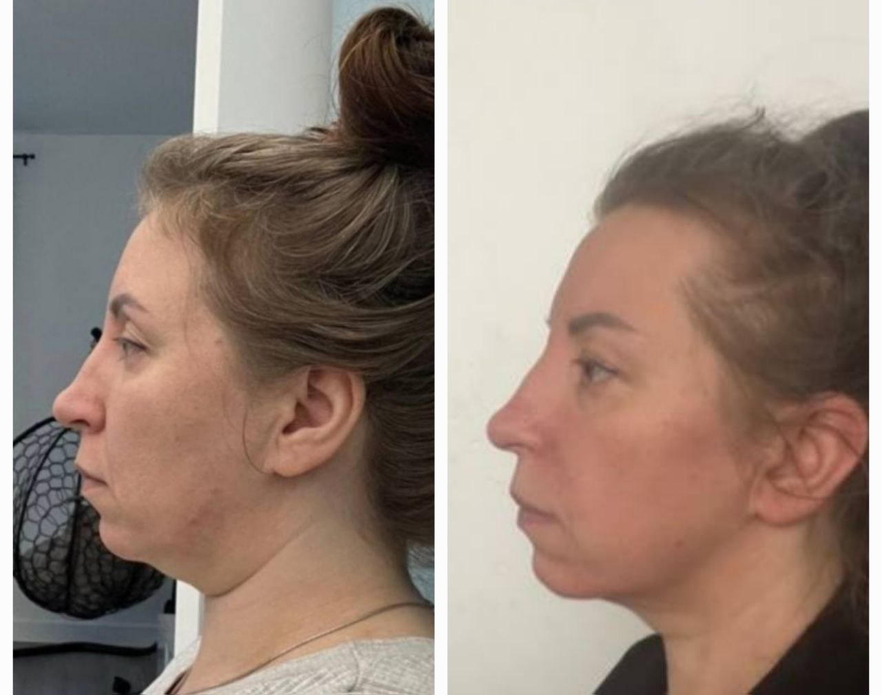 Student transformation before and after 19