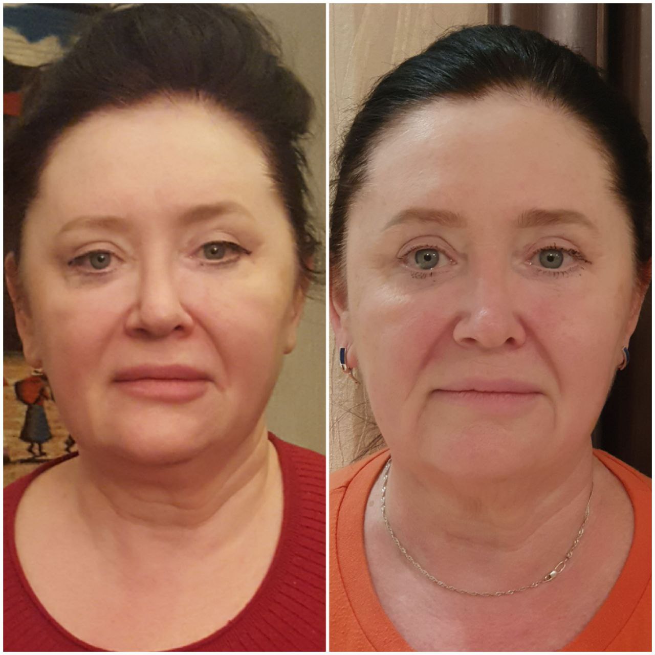 Student transformation before and after 17